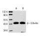 Western blot analysis of polyhistidine-tagged recombinant Adenovirus-2 E1A (13S): sc-4021 WB. Antibodies tested include Ad