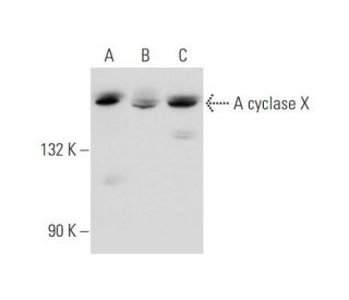 Adenylate cyclase 10/ADCY10 Antibody (B-1) - Western Blotting - Image 344118Each CRISPR/Cas9 Knockout (KO) Plasmid product consists of a pool of 3 plasmids designed to ensure identification and cleavage of a specific gene for maximum knockout efficiency. Each plasmid encodes a unique 20 nt sequence derived from the GeCKO (v2) library.