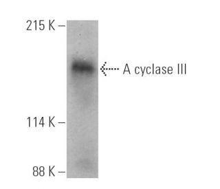 Adenylate cyclase 3/AC3/ADCY3 Antibody (E-8) - Western Blotting - Image 390939