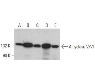Adenylate cyclase 5/6/ADCY5/ADCY6 Antibody (B-6) - Western Blotting - Image 381426