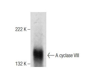 Adenylate cyclase 8/AC8/ADCY8 Antibody (B-6) - Western Blotting - Image 283477SAM Transcription Activation: SAM system utilizing dCas9-VP64, MS2-P65-HSF1, and sgRNA for precise gene transcription activation.