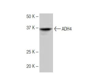 ADH4 Antibody (NB-B2) - Western Blotting - Image 64827 