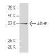 ADH6 Antibody (WW32) - Western Blotting - Image 33866