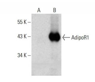 AdipoR1 Antibody (D-9) - Western Blotting - Image 386949Each CRISPR/Cas9 Knockout (KO) Plasmid product consists of a pool of 3 plasmids designed to ensure identification and cleavage of a specific gene for maximum knockout efficiency. Each plasmid encodes a unique 20 nt sequence derived from the GeCKO (v2) library.