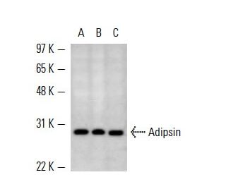 Adipsin Antibody (D10/4) - Western Blotting - Image 13621 
