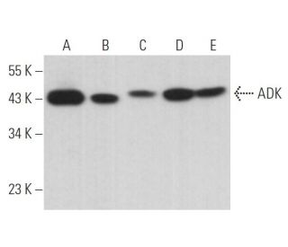 ADK Antibody (H-1) - Western Blotting - Image 364403 