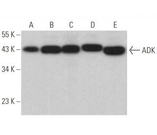 ADK Antibody (H-6) - Western Blotting - Image 359330