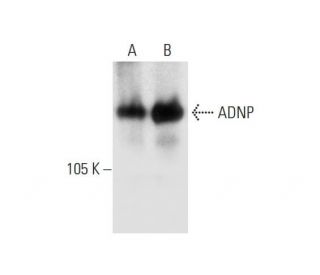 ADNP Antibody (F-5) - Western Blotting - Image 295742 