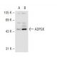 ADPGK Antibody (AA40) - Western Blotting - Image 62338