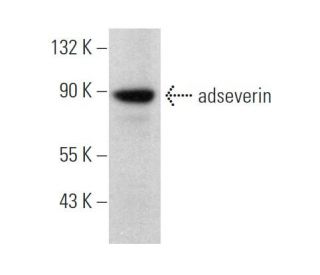 adseverin Antibody (C-2) - Western Blotting - Image 369761 
