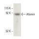 Afamin Antibody (G-10) - Western Blotting - Image 399493
