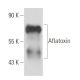 Aflatoxin Antibody (AFC-13) - Western Blotting - Image 15743