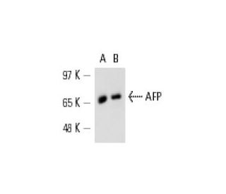 AFP/Alpha fetoprotein Antibody (AFP-11) - Western Blotting - Image 13902
