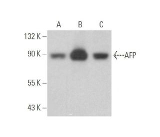 AFP/Alpha fetoprotein Antibody (39) - Western Blotting - Image 352746 