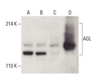 AGL Antibody (B-11) - Western Blotting - Image 399515 