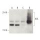AGL Antibody (B-11) - Western Blotting - Image 399515 