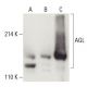 AGL Antibody (B-11) - Western Blotting - Image 399516 