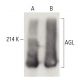 AGL Antibody (B-11) - Western Blotting - Image 399517