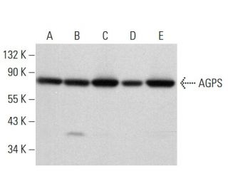 AGPS Antibody (B-9) - Western Blotting - Image 377088 