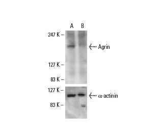 Agrin siRNA (m): sc-29653. Western blot analysis of Agrin expression in non-transfected control (A) and Agrin siRNA transf 