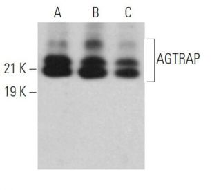 AGTRAP Antibody (F-6) - Western Blotting - Image 371607 