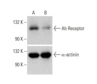 Ah Receptor Double Nickase Plasmid (h2): sc-400297-NIC. Western blot analysis of Ah Receptor expression in non-transfected 