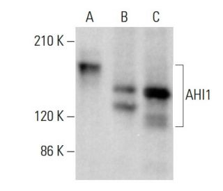 AHI1 Antibody (B-2) - Western Blotting - Image 379087 