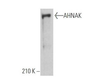 AHNAK Antibody (E-5) - Western Blotting - Image 363602Each CRISPR/Cas9 Knockout (KO) Plasmid product consists of a pool of 3 plasmids designed to ensure identification and cleavage of a specific gene for maximum knockout efficiency. Each plasmid encodes a unique 20 nt sequence derived from the GeCKO (v2) library.