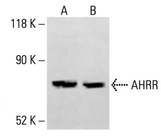 AHRR Antibody (5G11) - Western Blotting - Image 414183 