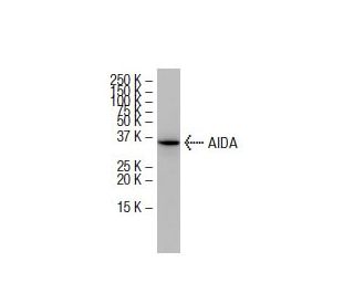 AIDA Antibody (7F6) - Western Blotting - Image 33517 