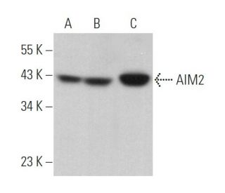 AIM2 Antibody (F-11) - Western Blotting - Image 369856Each CRISPR/Cas9 Knockout (KO) Plasmid product consists of a pool of 3 plasmids designed to ensure identification and cleavage of a specific gene for maximum knockout efficiency. Each plasmid encodes a unique 20 nt sequence derived from the GeCKO (v2) library.