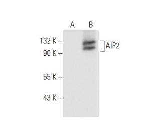 AIP2 Antibody (A-5) - Western Blotting - Image 68462