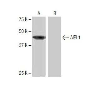 AIPL1 Antibody (5-RY34) - Western Blotting - Image 64832
