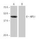 AIPL1 Antibody (5-RY34) - Western Blotting - Image 64832