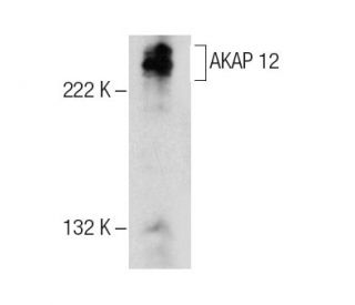 AKAP 12 Antibody (C-12) - Western Blotting - Image 158455Each CRISPR/Cas9 Knockout (KO) Plasmid product consists of a pool of 3 plasmids designed to ensure identification and cleavage of a specific gene for maximum knockout efficiency. Each plasmid encodes a unique 20 nt sequence derived from the GeCKO (v2) library.