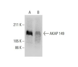 AKAP 149 Antibody (H-8) - Western Blotting - Image 294644