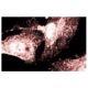 AKAP 79 Antibody (22) - Immunofluorescence - Image 60546