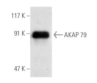 AKAP 79 Antibody (D-9) - Western Blotting - Image 3409 