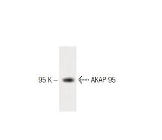 AKAP 95 Antibody (47) - Western Blotting - Image 60177 