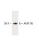 AKAP 95 Antibody (47) - Western Blotting - Image 60177 