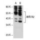 AKR7A2 Antibody (Y02) - Western Blotting - Image 109246