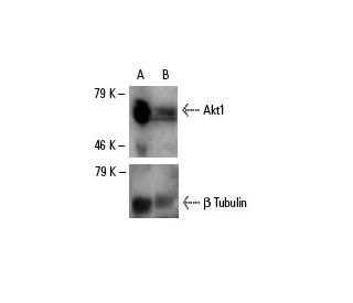 Akt1 siRNA (h): sc-29195. Western blot analysis of Akt1 expression in non-transfected control (A) and Akt1 siRNA double tr 