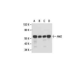 Akt2 Antibody (1G8C12) - Western Blotting - Image 18173 