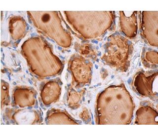 Akt2 Antibody (F-7) - Immunohistochemistry - Image 353771 