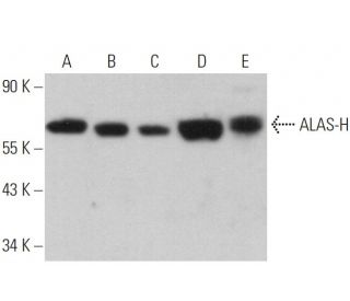 ALAS-H Antibody (F-5) - Western Blotting - Image 359220 