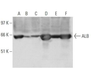 ALB/Albumin Antibody (1D6) - Western Blotting - Image 14829 