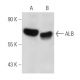 ALB/Albumin Antibody (1G2) - Western Blotting - Image 15405 