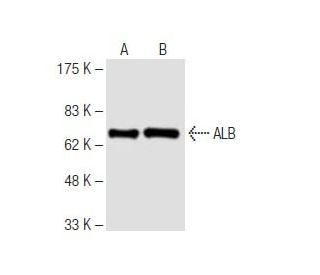 ALB/Albumin Antibody (1G2) - Western Blotting - Image 62860 