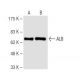 ALB/Albumin Antibody (1G2) - Western Blotting - Image 62860 