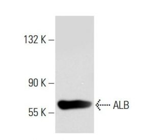 ALB/Albumin Antibody (AL-01) - Western Blotting - Image 45733 